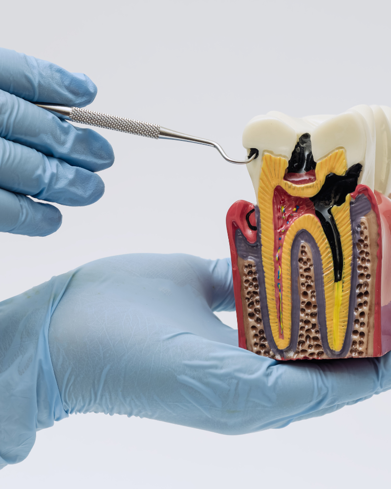 Endodoncia